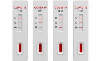 Тест на антитела к коронавирусу — что это и где сдать