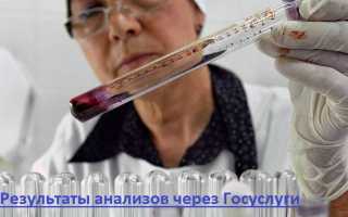 Результаты медицинских анализов теперь можно получить по электронной почте